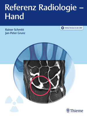 cover image of Referenz Radiologie: Hand
